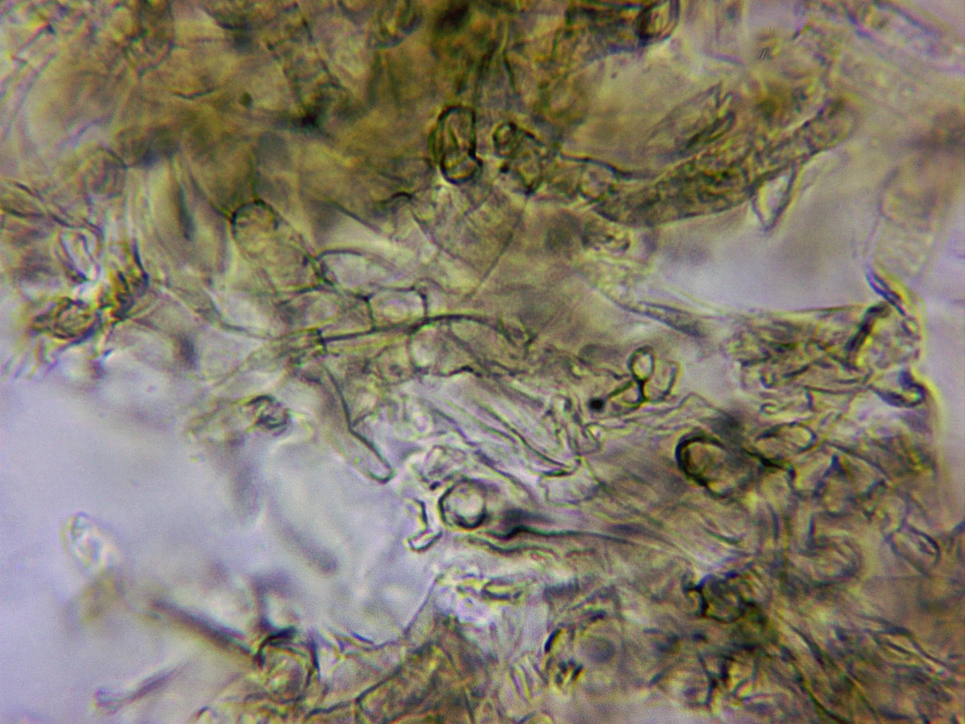 Microscopía de Meottomyces dissimulans - 10 - Pileipellis frontal agua